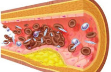 bajar el colesterol a través de la alimentación